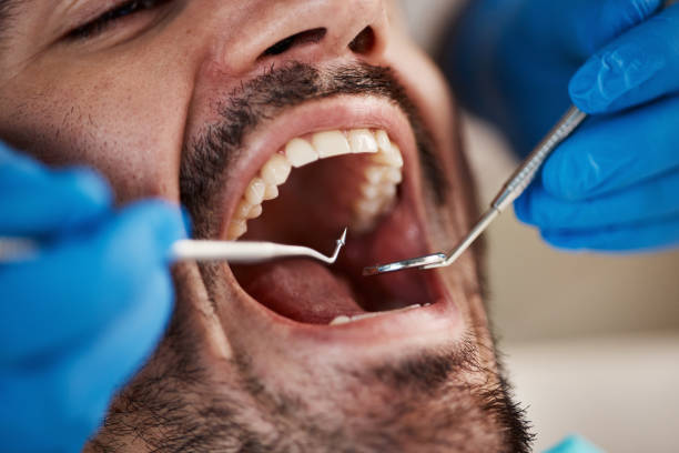 Best 24-Hour Emergency Dental Care in Warrenvle, IL