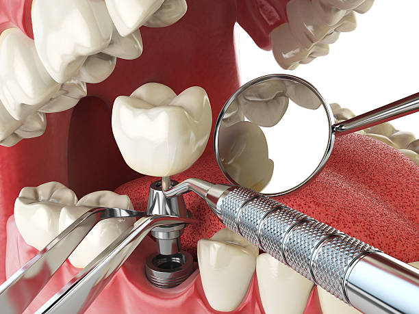 Best Emergency Dental Care for Sports Injuries in Warrenvle, IL